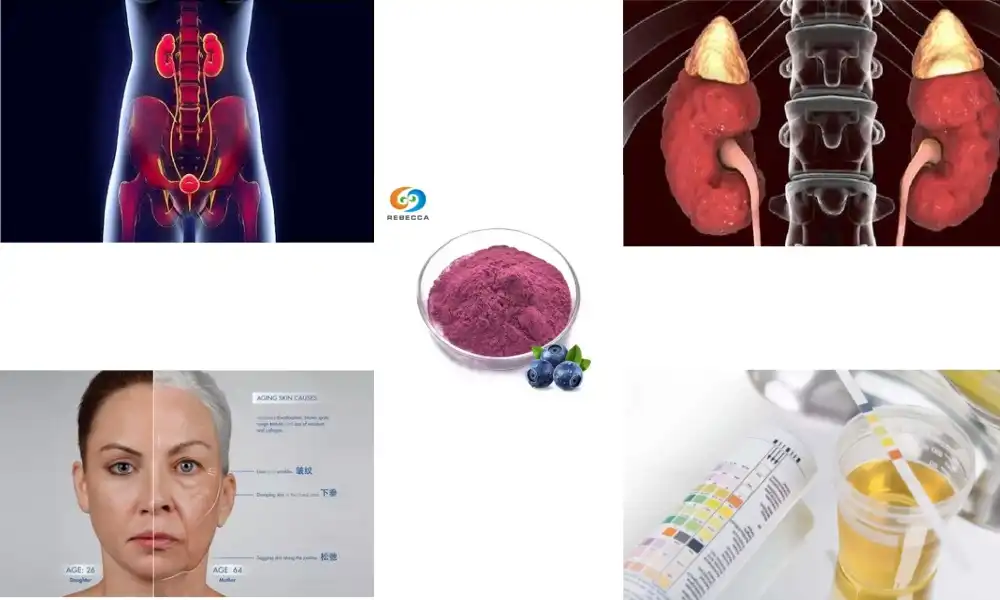 How does cranberry extract support urinary tract health?